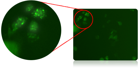Fluorescent positive GFP-LC3 cells
