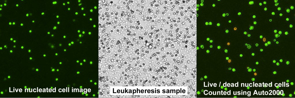 Cell Images of Leokapheresis Sample with bright field, live cells in green fluorescence and counted TNC