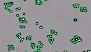 Cellometer Auto T4 counted cell image shows individual counted cells outlined in green.
