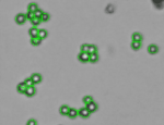 Clumpy Cells identified with Cellometer Auto 1000