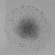 Spheroid image showing cell outgrowth 1