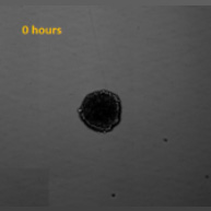 Image on hour 0 of spheroid outgrowth