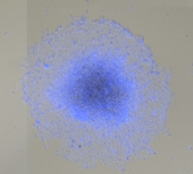 Tumorspheroid image showing outgrowth 2