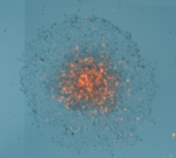 Spheroid image showing cell outgrowth 4