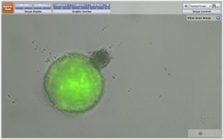 GFP labeled 3D tumor spheroid and a 3D astrocyte 2