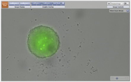 GFP labeled 3D tumor spheroid and a 3D astrocyte 4