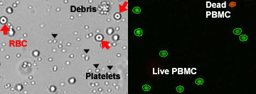 RBCs and platelets among PBMCs