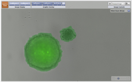 Confluence ratio 3D spheroid and 3D astrocyte 1