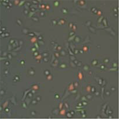 GFP+, RFP+ cell image