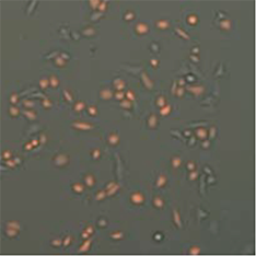 GFP-, RFP+ cell image