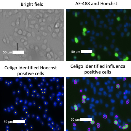 Bright field and fluorescent images of infected cells