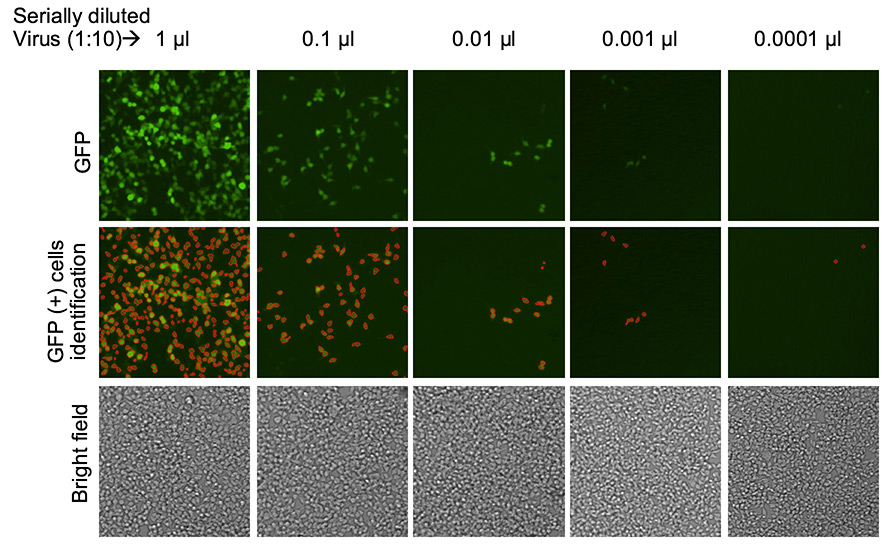 Bright field, fluorescent, and counted images of lentiviral titration for transduction