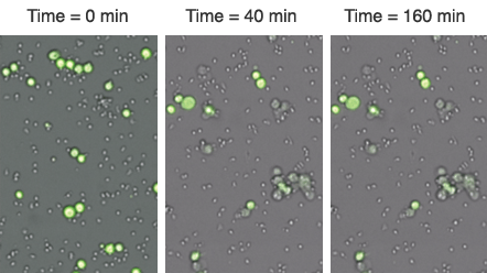 Image of live tumor cells at multiple time points