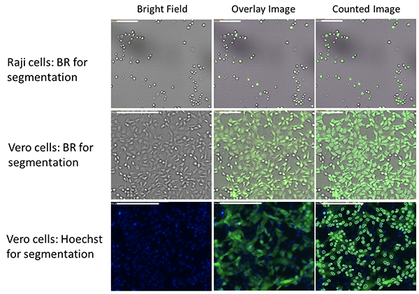 Bright field and fluorescent images of GFP-expressing infected cells