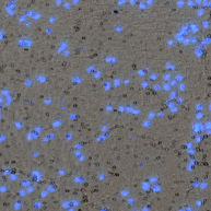 Bright field and DAPI overlay image of transwell invasion