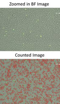 image of zika infected cells counted