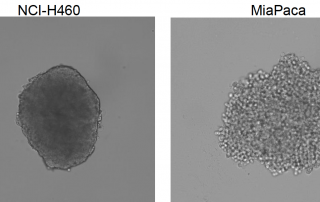 Celigo captured representative bright field images of non-drug treated NCI-H460 and MiaPaca multicellular tumor spheroids at normoxic condition on day 0