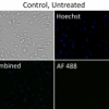 control untreated cell images