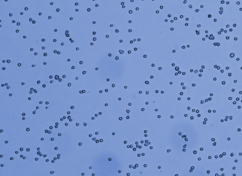 trypan blue stained cells