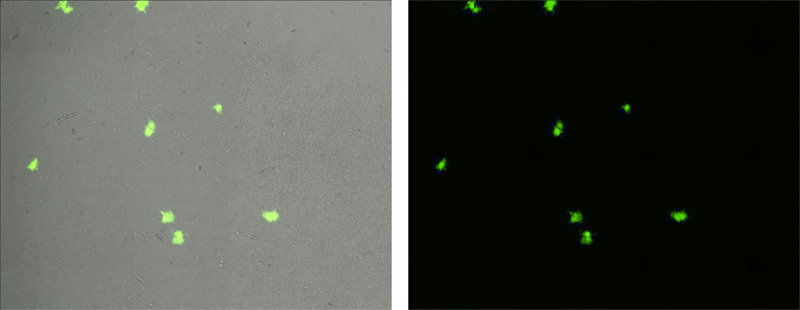 fluorescent images of GFP-RSV infected foci