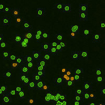 fluorescent image of mouse lymphocytes